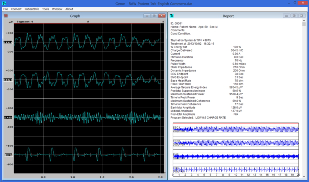 EEG分析ソフトウェアGenieIVのモニタリング及びレポート表示